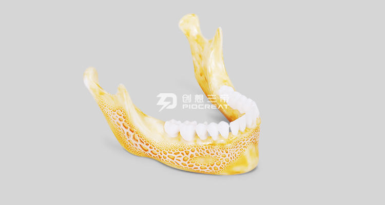 How about Printing dental 3D models accurately?