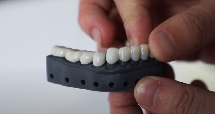 How To Make Invisible Temporary Crown By DJ89 LCD 3D Printer？