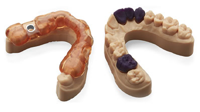 How about the clinical application effect of dental 3D printer?